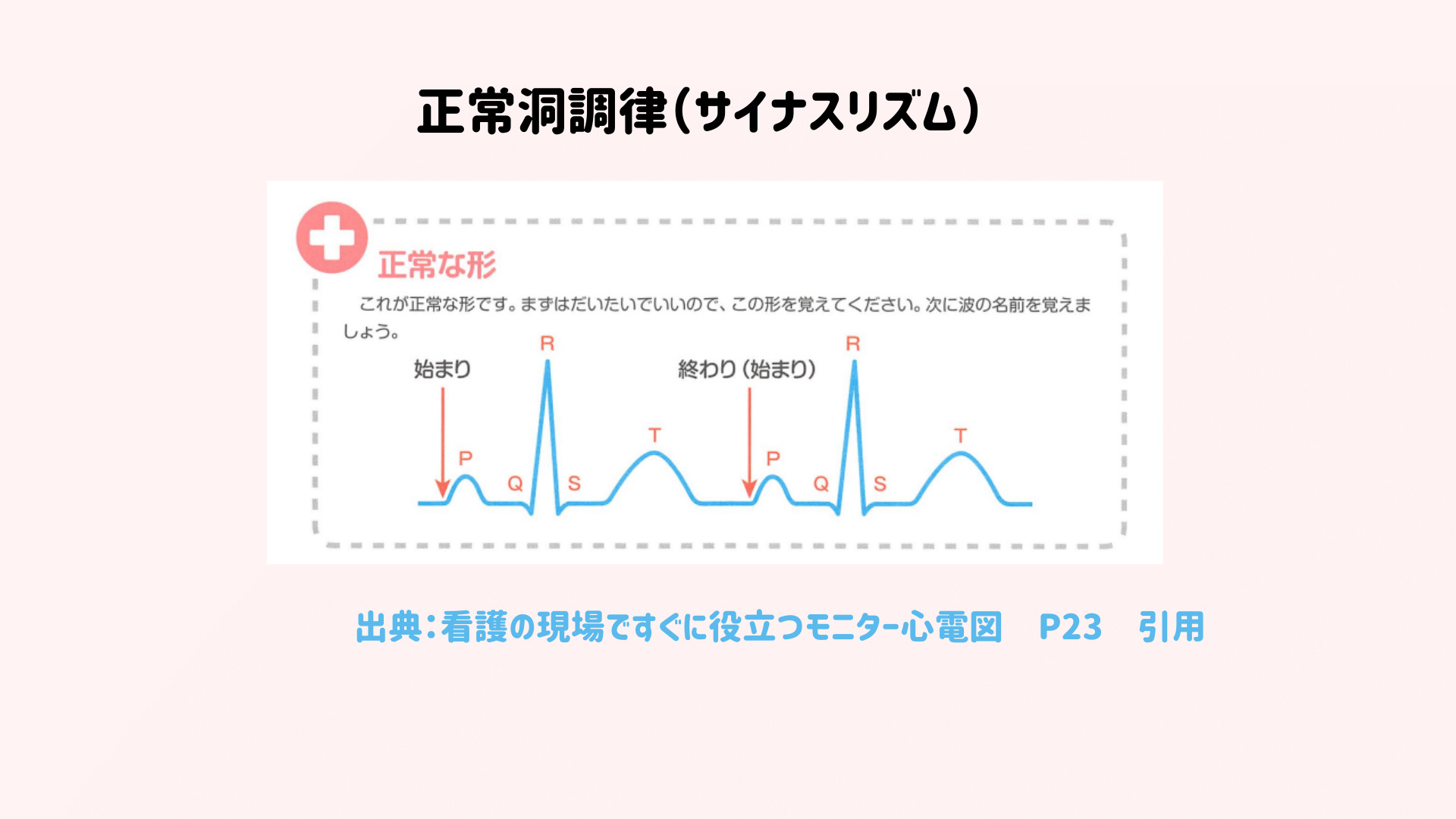 Nsr Or Sr